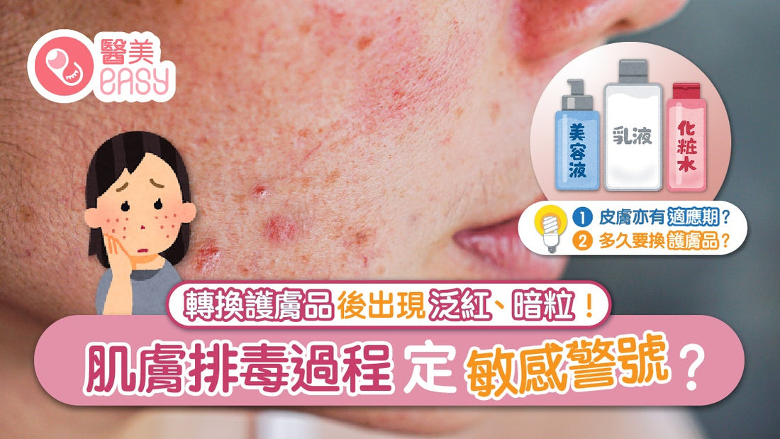 女士護膚|轉新護膚品出現泛紅暗粒 如何區分皮膚排毒還是過敏?