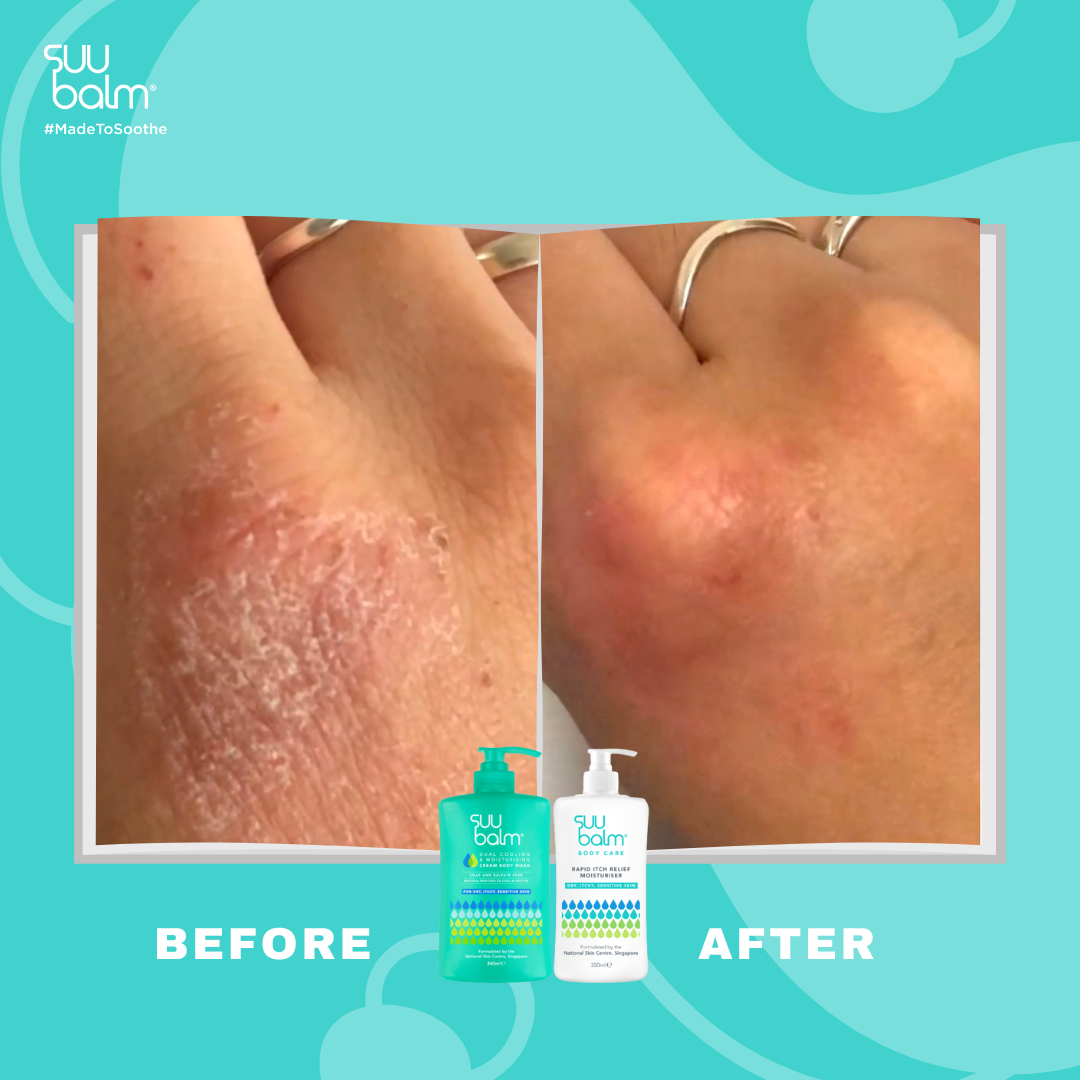 Suu Balm® 速效舒敏沐浴露 (補充裝)