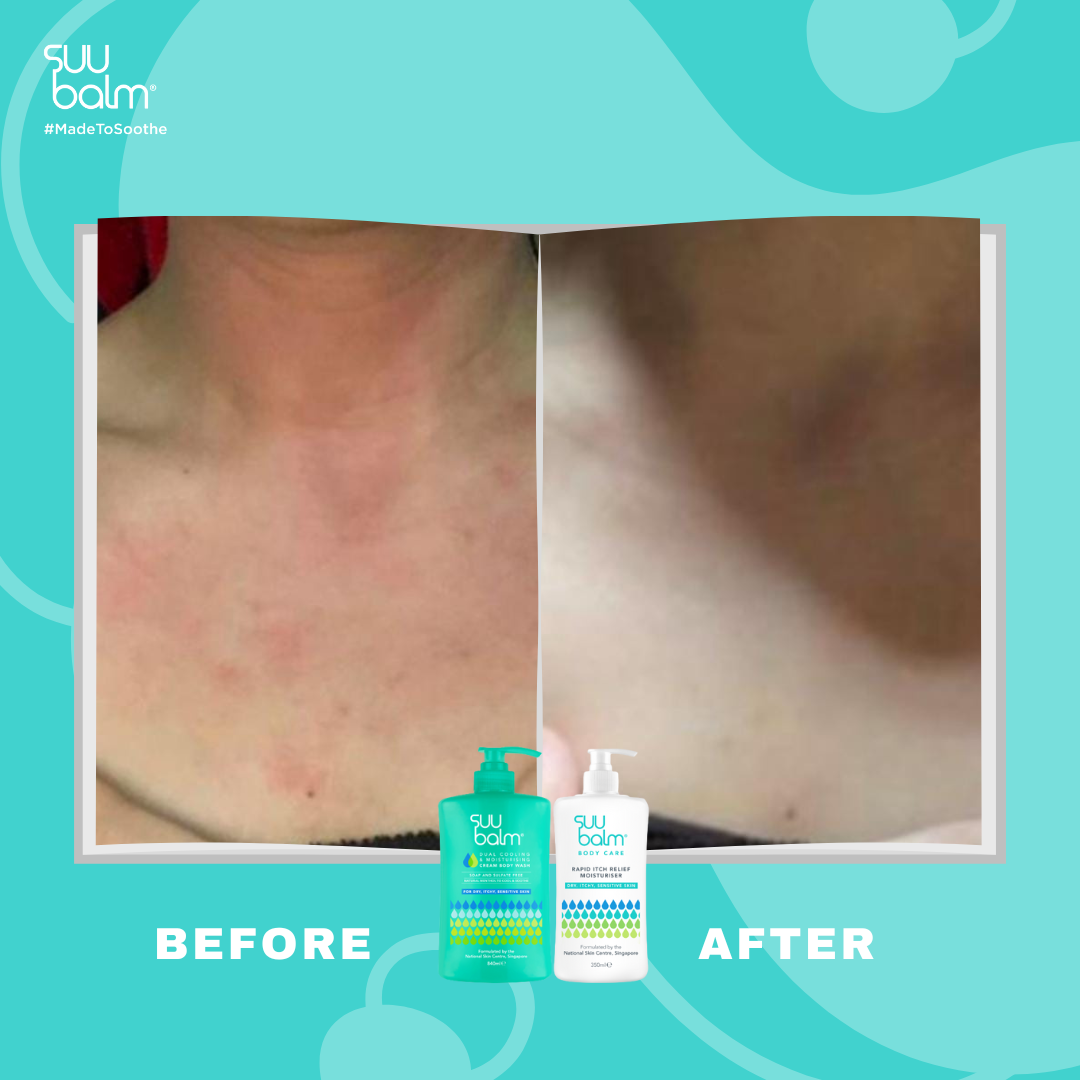 Suu Balm® 速效舒敏沐浴露 (補充裝)