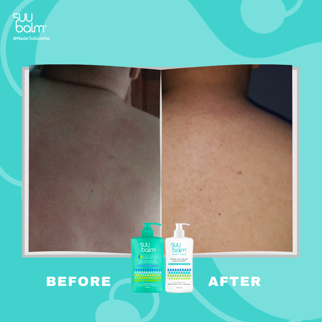 Suu Balm® 速效舒敏沐浴露 (補充裝)