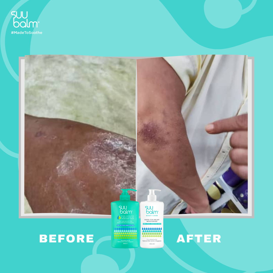 Suu Balm® 速效舒敏沐浴露420ml