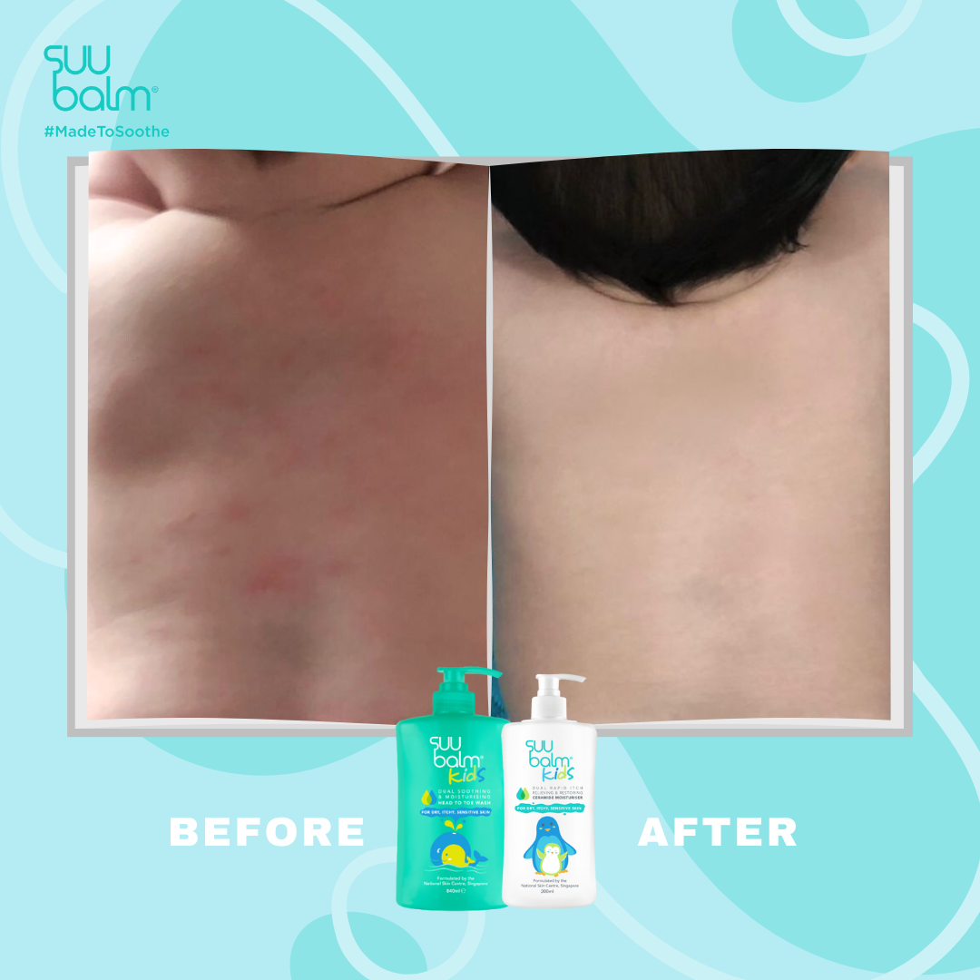 Suu Balm® 速效舒敏沐浴露 (嬰幼兒配方) (補充裝)