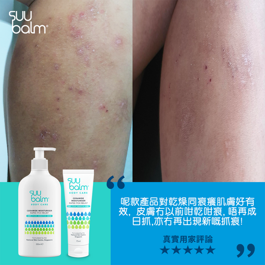 Suu Balm® Rapid Itch Relief Moisturiser 75ml