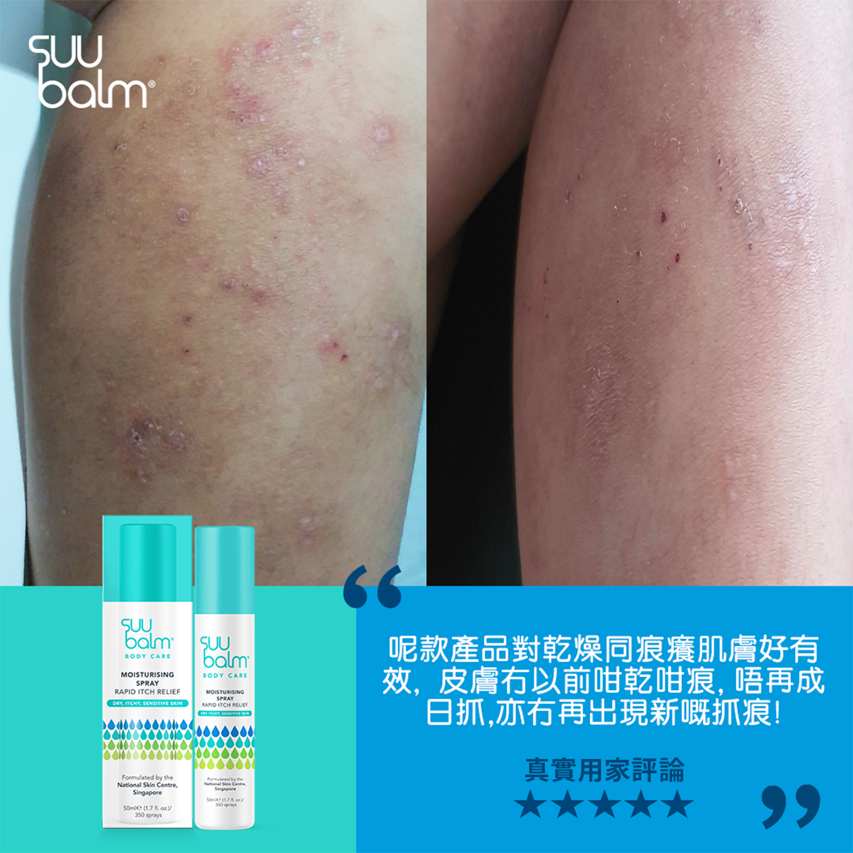 Suu Balm® 速效舒敏保濕噴霧 50ml