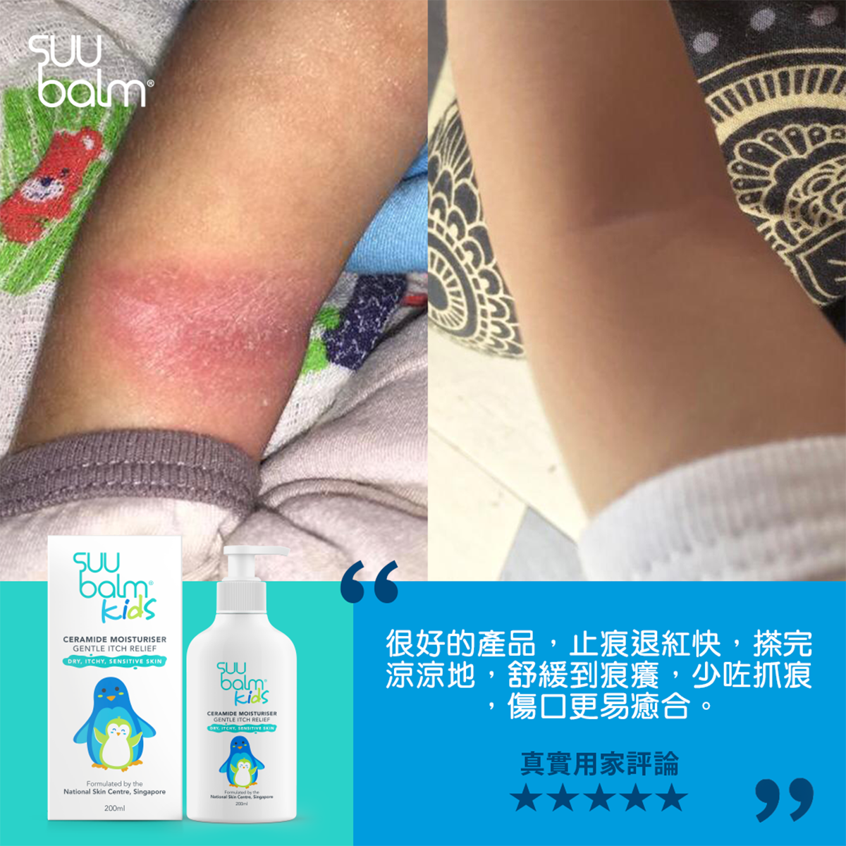 Suu Balm® Kids Dual Rapid Itch Relieving and Restoring Ceramide Moisturiser 200ml