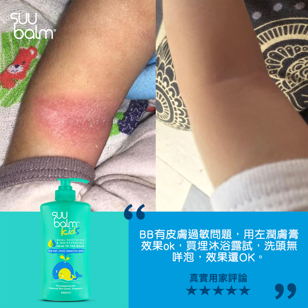 Suu Balm® 速效舒敏沐浴露(嬰幼兒配方) 420ml