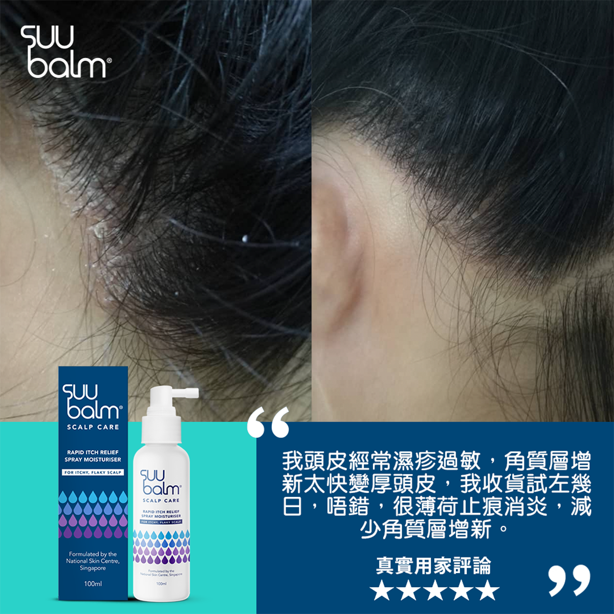 Suu Balm® 速效舒敏頭皮保濕噴霧