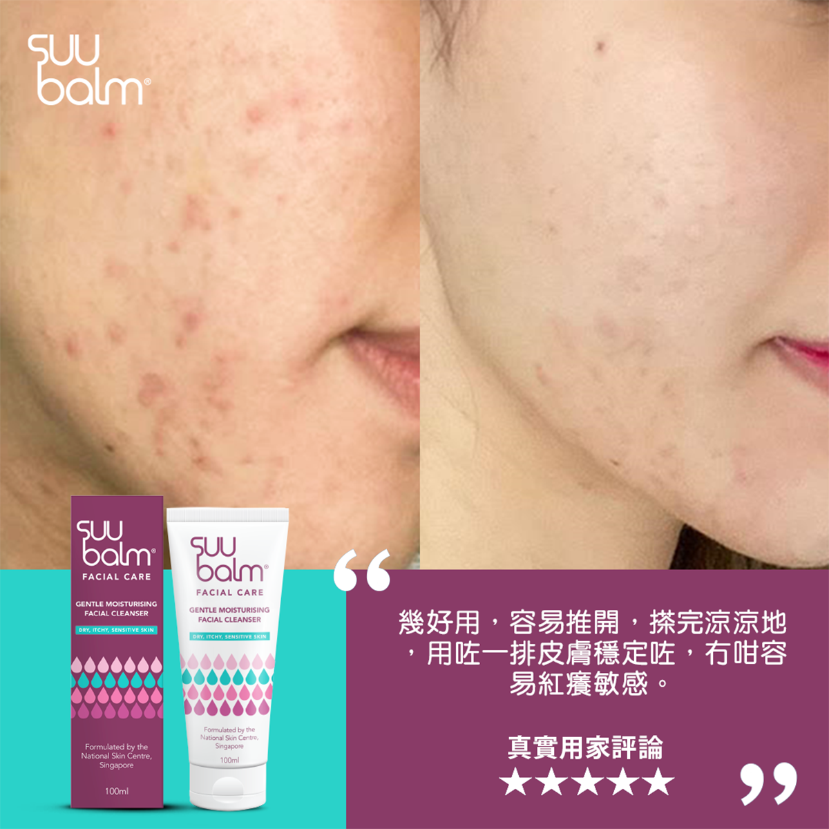 Suu Balm® 面部修護套裝