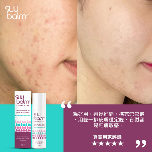Suu Balm® Cooling Itch Relief Facial Moisturiser 50ml