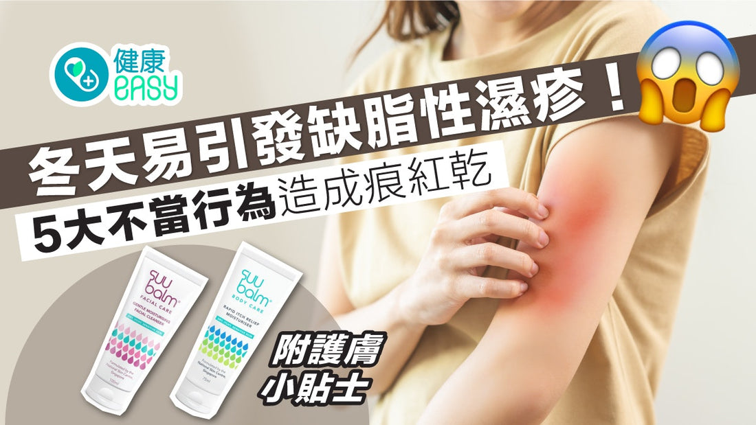 濕疹｜冬天易引發缺脂性濕疹！5大不當行為造成痕紅乾