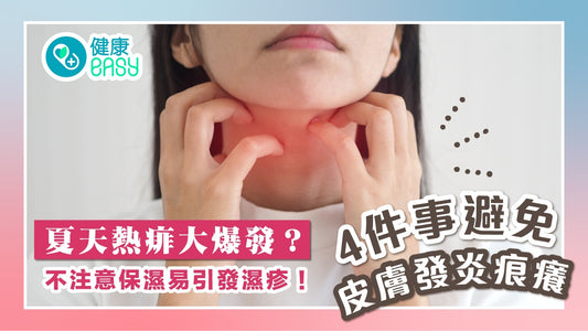夏天熱痱大爆發？不注意保濕易引發濕疹！四件事避免皮膚發炎痕癢