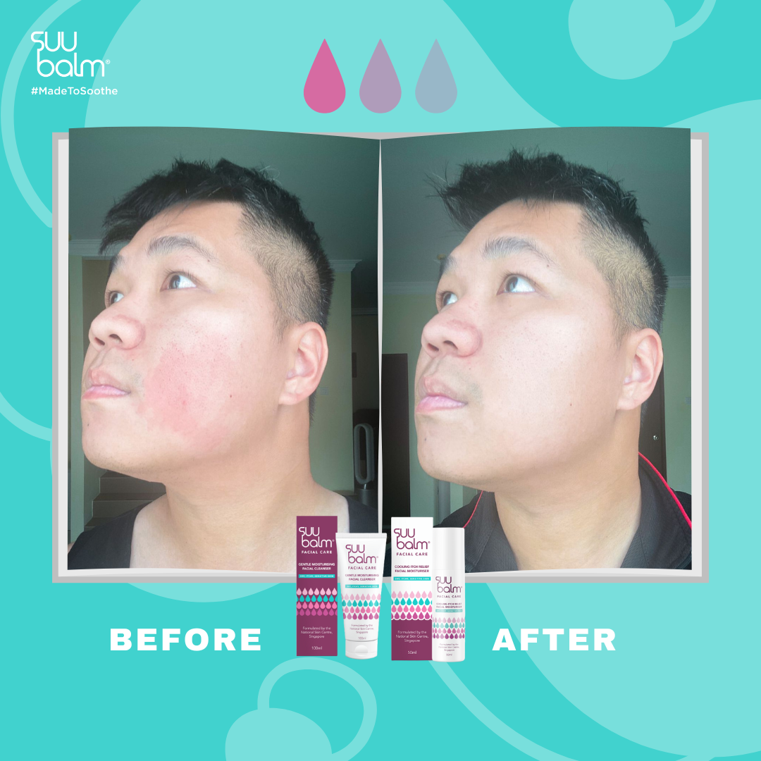 Suu Balm® Cooling Itch Relief Facial Moisturiser 50ml 