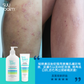 Suu Balm® 終極濕疹優惠套裝A