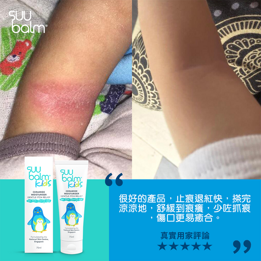 Suu Balm® 速效舒敏保濕乳(嬰幼兒配方) 75ml