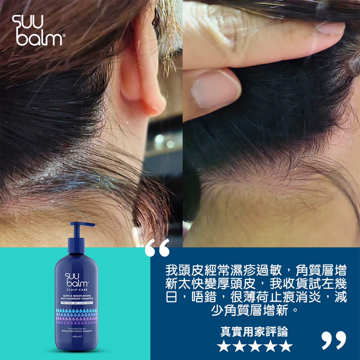 Suu Balm® 速效舒敏抗屑洗髮乳