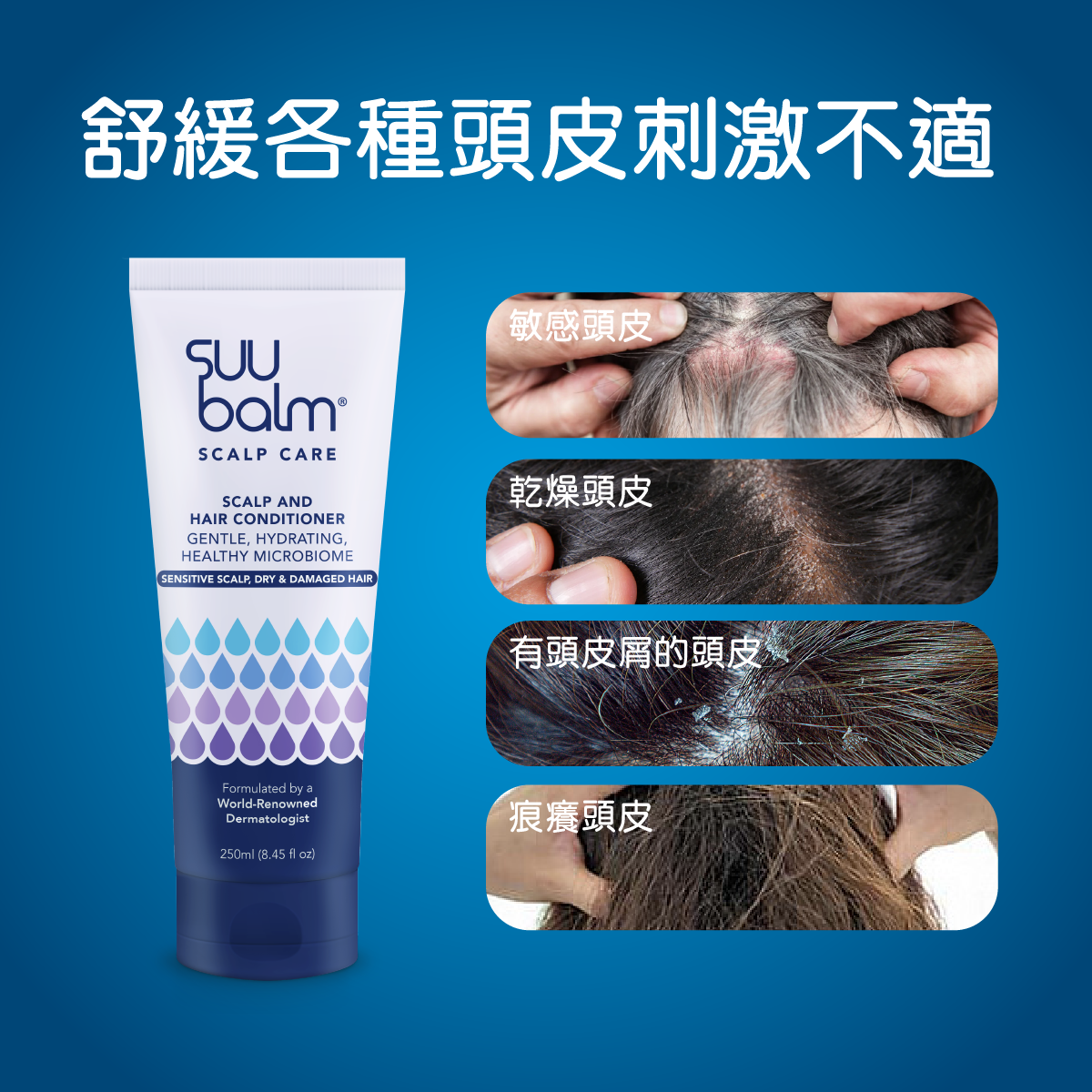 Suu Balm® 速效舒敏頭皮護髮素