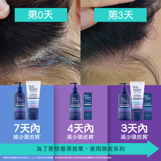 Suu Balm® Instant Sensitive Scalp Conditioner